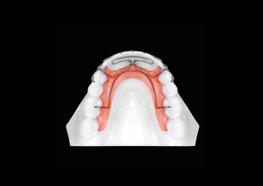 Active Retainer view 1